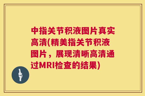 中指关节积液图片真实高清(精美指关节积液图片，展现清晰高清通过MRI检查的结果)