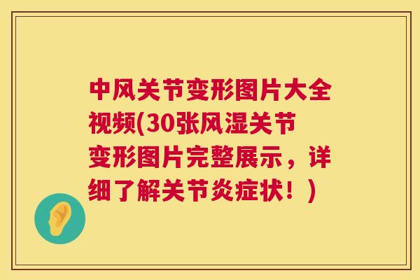 中风关节变形图片大全视频(30张风湿关节变形图片完整展示，详细了解关节炎症状！)