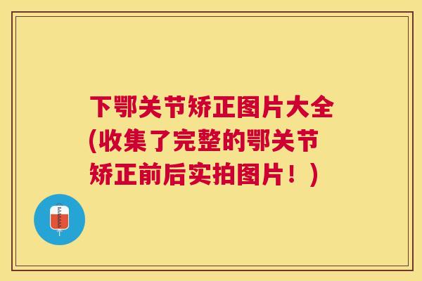 下鄂关节矫正图片大全(收集了完整的鄂关节矫正前后实拍图片！)