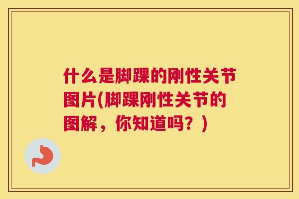 什么是脚踝的刚性关节图片(脚踝刚性关节的图解，你知道吗？)