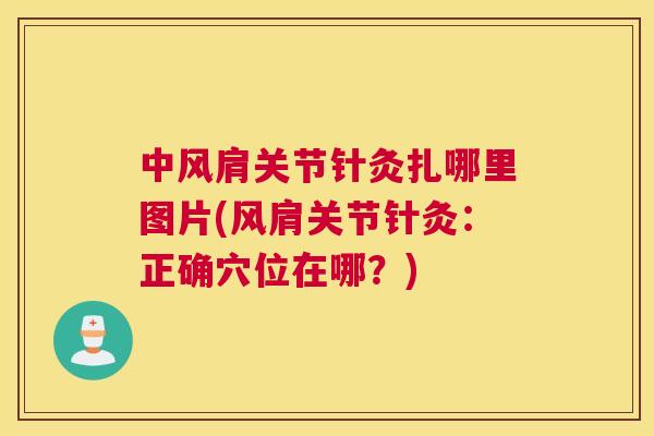 中风肩关节针灸扎哪里图片(风肩关节针灸：正确穴位在哪？)
