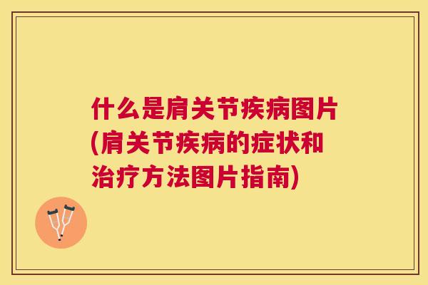 什么是肩关节疾病图片(肩关节疾病的症状和治疗方法图片指南)