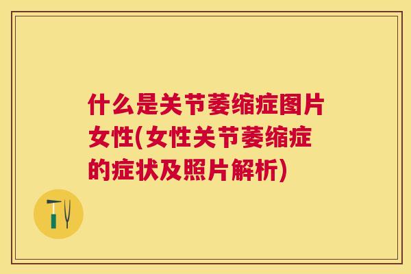 什么是关节萎缩症图片女性(女性关节萎缩症的症状及照片解析)