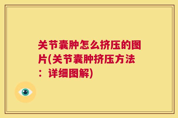 关节囊肿怎么挤压的图片(关节囊肿挤压方法：详细图解)