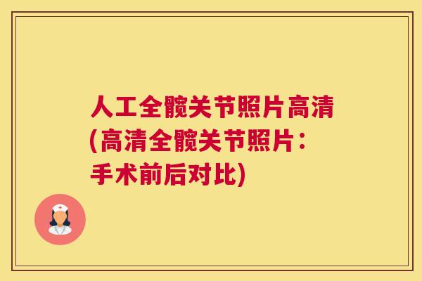 人工全髋关节照片高清(高清全髋关节照片：手术前后对比)