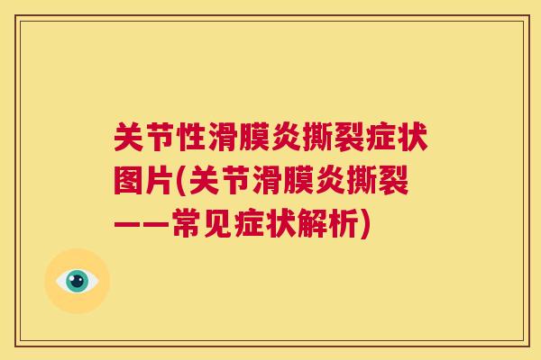 关节性撕裂症状图片(关节撕裂——常见症状解析)
