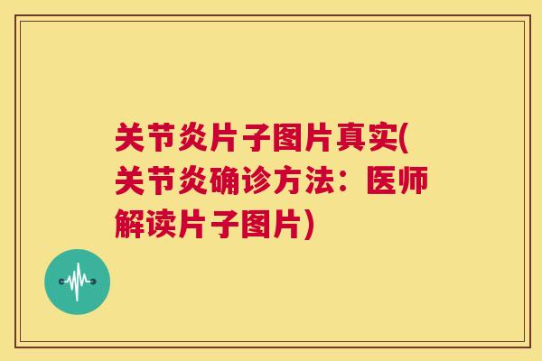 关节炎片子图片真实(关节炎确诊方法：医师解读片子图片)