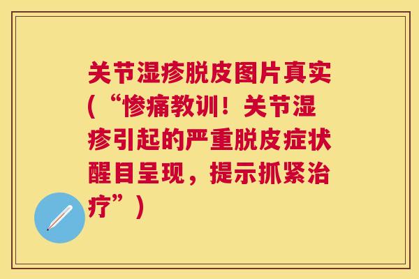 关节湿疹脱皮图片真实(“惨痛教训！关节湿疹引起的严重脱皮症状醒目呈现，提示抓紧治疗”)