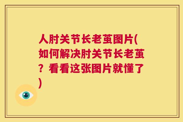 人肘关节长老茧图片(如何解决肘关节长老茧？看看这张图片就懂了)