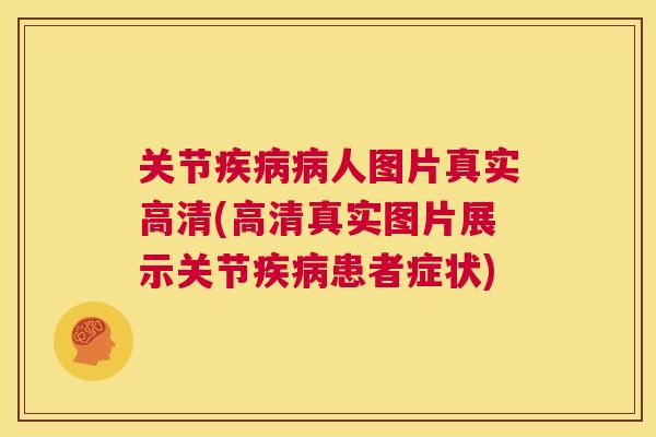 关节疾病病人图片真实高清(高清真实图片展示关节疾病患者症状)
