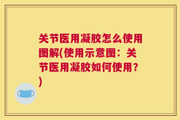 关节医用凝胶怎么使用图解(使用示意图：关节医用凝胶如何使用？)