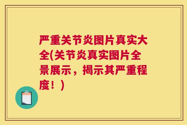 严重关节炎图片真实大全(关节炎真实图片全景展示，揭示其严重程度！)