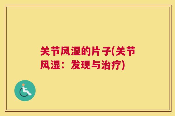 关节风湿的片子(关节风湿：发现与治疗)