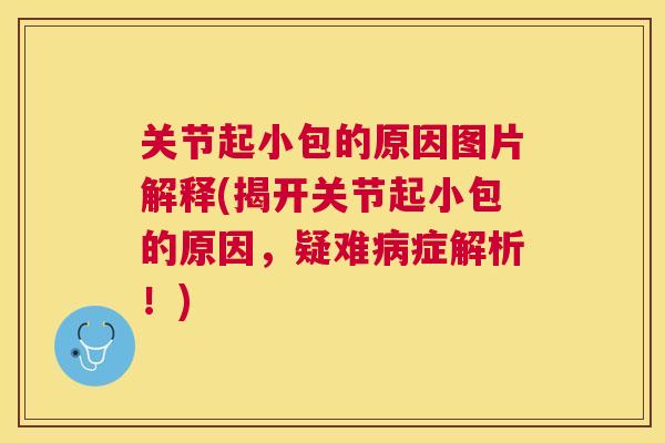 关节起小包的原因图片解释(揭开关节起小包的原因，疑难病症解析！)