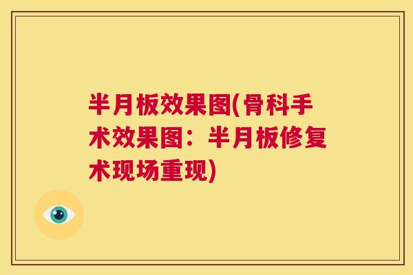 半月板效果图(骨科手术效果图：半月板修复术现场重现)