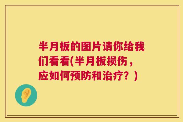 的图片请你给我们看看(损伤,应如何和?) 的图片请你给我们看看(损伤,应如何和?)