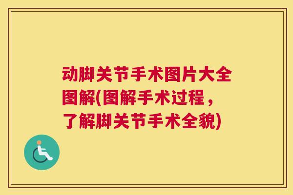 动脚关节手术图片大全图解(图解手术过程，了解脚关节手术全貌)
