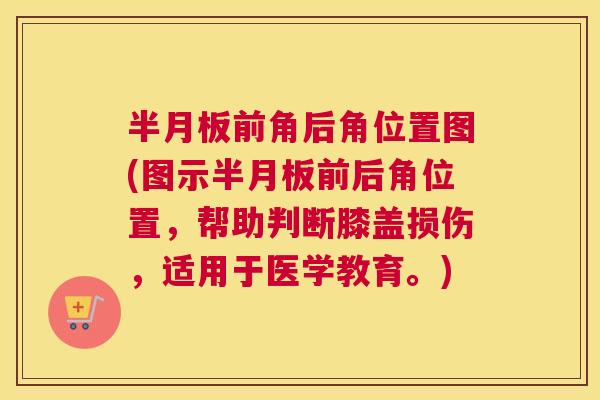 半月板前角后角位置图(图示半月板前后角位置，帮助判断膝盖损伤，适用于医学教育。)