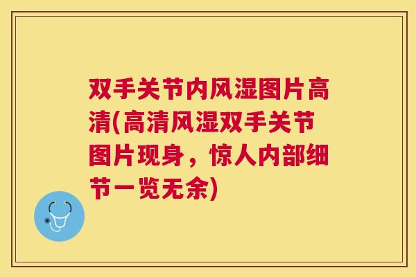 双手关节内风湿图片高清(高清风湿双手关节图片现身，惊人内部细节一览无余)
