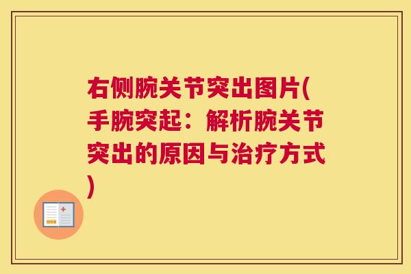 右侧腕关节突出图片(手腕突起：解析腕关节突出的原因与治疗方式)