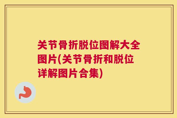 关节骨折脱位图解大全图片(关节骨折和脱位详解图片合集)