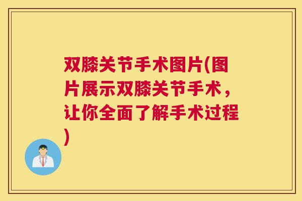 双膝关节手术图片(图片展示双膝关节手术，让你全面了解手术过程)