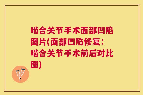 啮合关节手术面部凹陷图片(面部凹陷修复：啮合关节手术前后对比图)