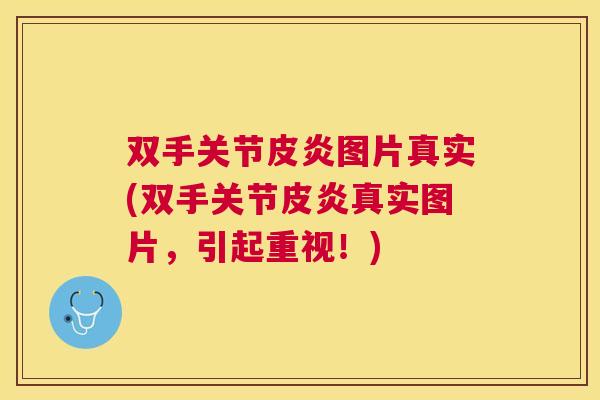 双手关节皮炎图片真实(双手关节皮炎真实图片，引起重视！)