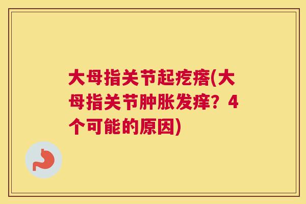 大母指关节起疙瘩(大母指关节肿胀发痒？4个可能的原因)