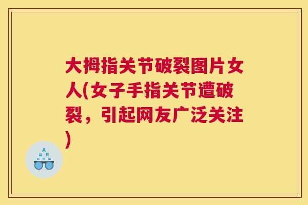 大拇指关节破裂图片女人(女子手指关节遭破裂，引起网友广泛关注)
