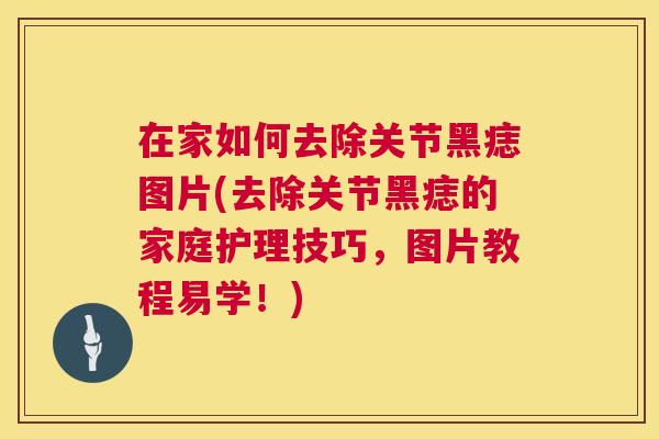 在家如何去除关节黑痣图片(去除关节黑痣的家庭护理技巧，图片教程易学！)
