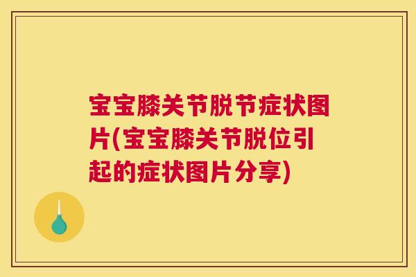 宝宝膝关节脱节症状图片(宝宝膝关节脱位引起的症状图片分享)