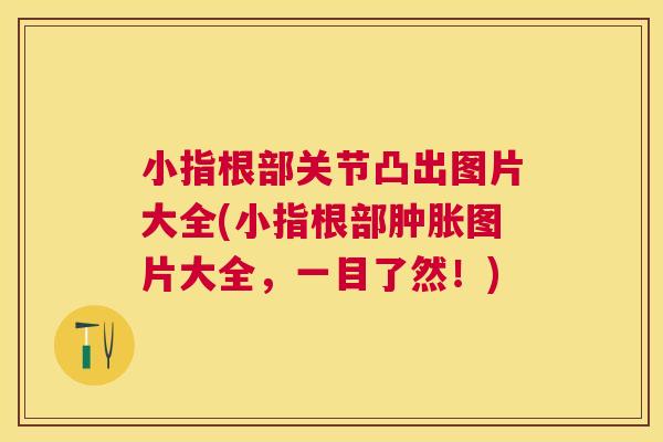 小指根部关节凸出图片大全(小指根部肿胀图片大全，一目了然！)