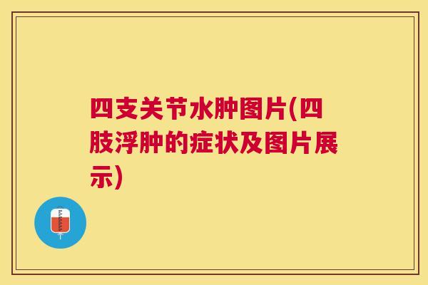 四支关节水肿图片(四肢浮肿的症状及图片展示)