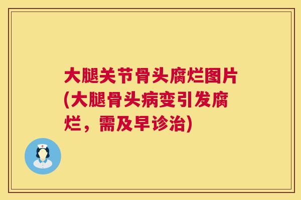 大腿关节骨头腐烂图片(大腿骨头病变引发腐烂，需及早诊治)