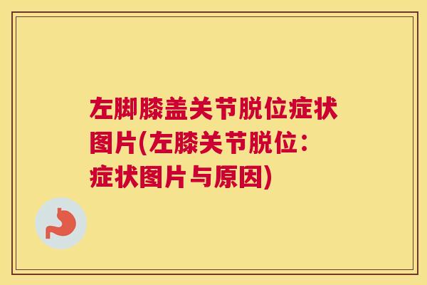 左脚膝盖关节脱位症状图片(左膝关节脱位：症状图片与原因)