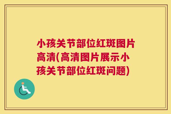 小孩关节部位红斑图片高清(高清图片展示小孩关节部位红斑问题)