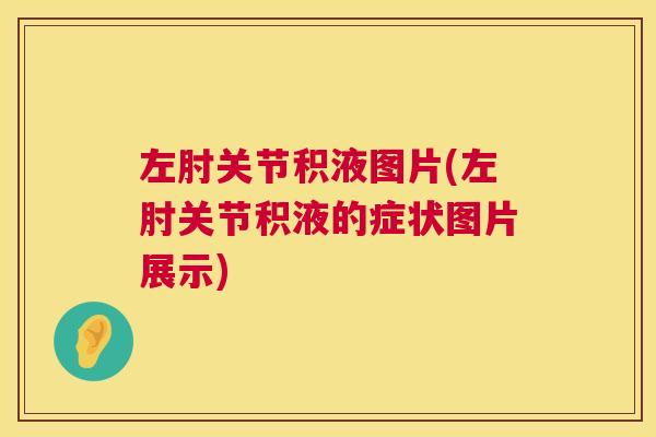 左肘关节积液图片(左肘关节积液的症状图片展示)