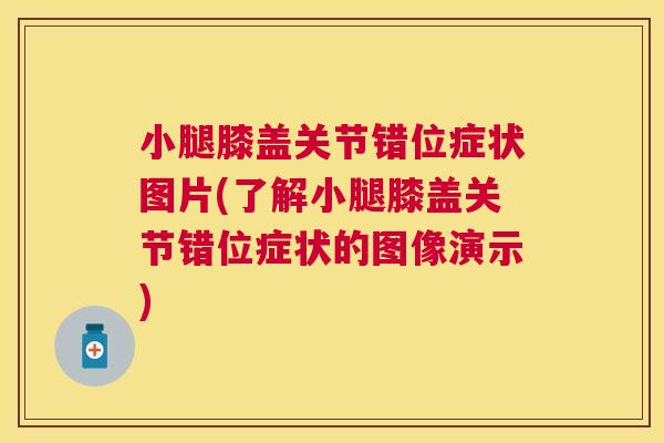 小腿膝盖关节错位症状图片(了解小腿膝盖关节错位症状的图像演示)