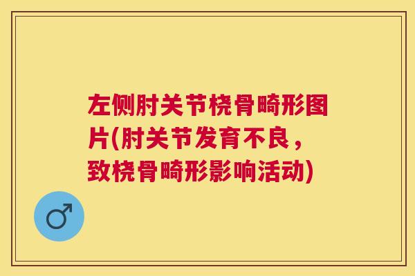 左侧肘关节桡骨畸形图片(肘关节发育不良，致桡骨畸形影响活动)