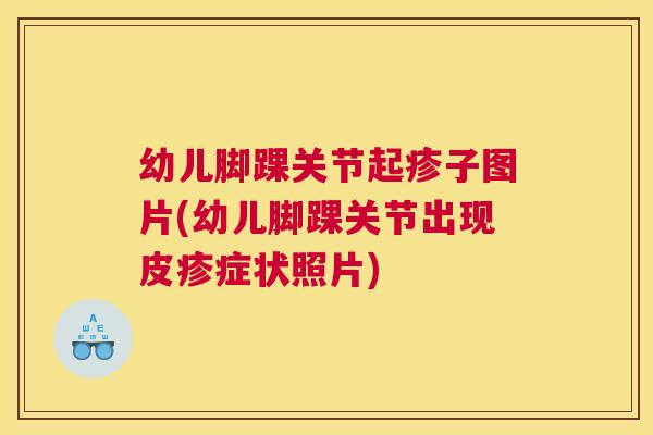 幼儿脚踝关节起疹子图片(幼儿脚踝关节出现皮疹症状照片)