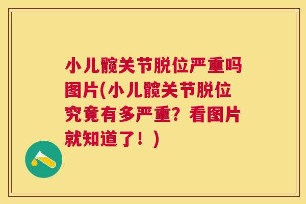 小儿髋关节脱位严重吗图片(小儿髋关节脱位究竟有多严重？看图片就知道了！)