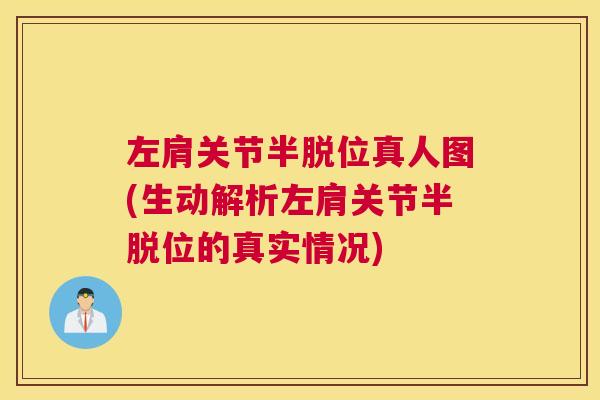 左肩关节半脱位真人图(生动解析左肩关节半脱位的真实情况)