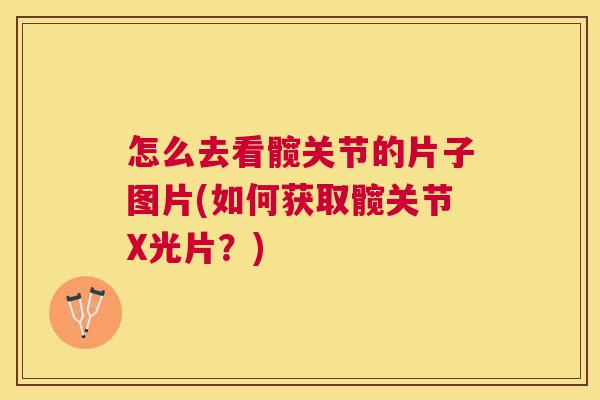 怎么去看髋关节的片子图片(如何获取髋关节X光片？)