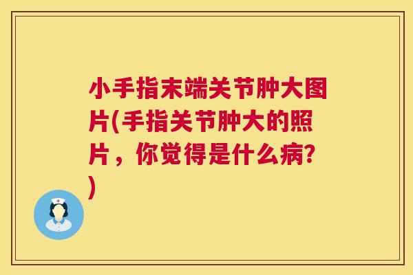 小手指末端关节肿大图片(手指关节肿大的照片，你觉得是什么病？)
