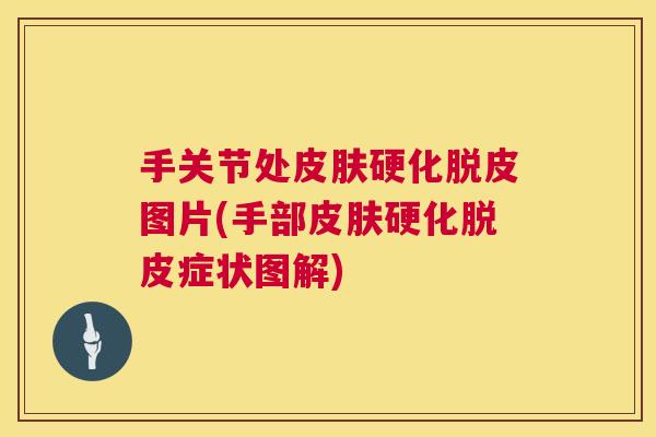 手关节处皮肤硬化脱皮图片(手部皮肤硬化脱皮症状图解)
