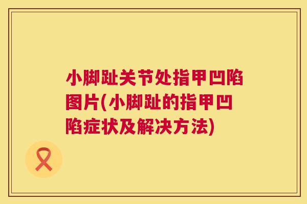 小脚趾关节处指甲凹陷图片(小脚趾的指甲凹陷症状及解决方法)