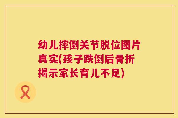 幼儿摔倒关节脱位图片真实(孩子跌倒后揭示家长育儿不足) 幼儿摔倒关节脱位图片真实(孩子跌倒后揭示家长育儿不足)
