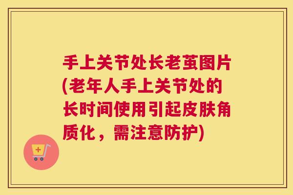 手上关节处长老茧图片(老年人手上关节处的长时间使用引起皮肤角质化，需注意防护)