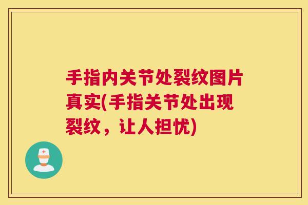 手指内关节处裂纹图片真实(手指关节处出现裂纹，让人担忧)